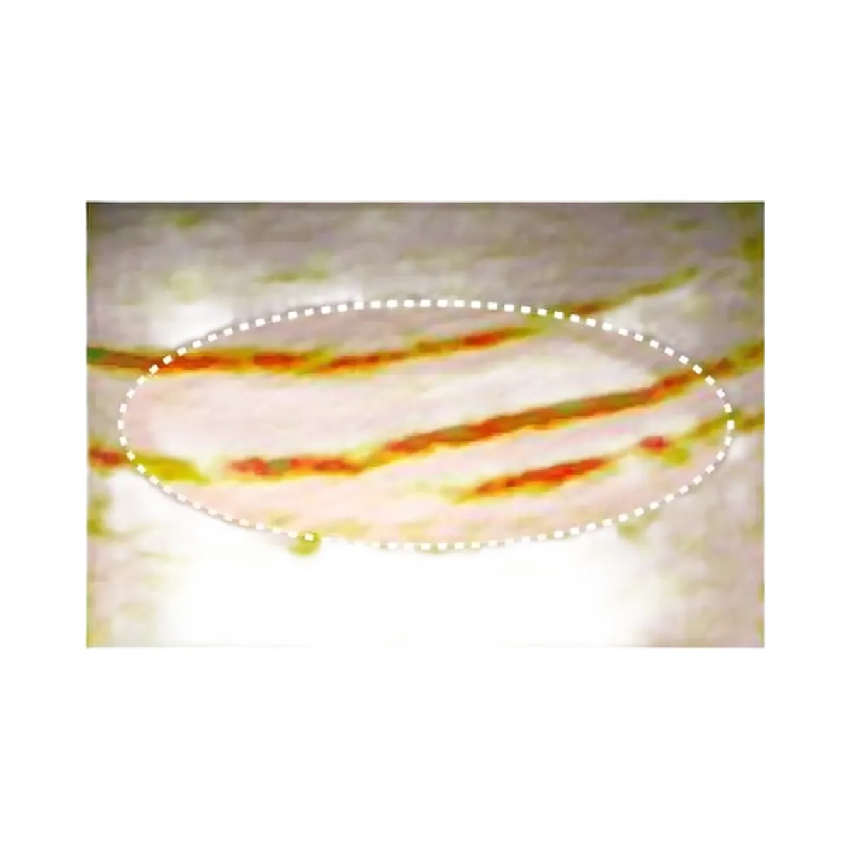 ANUA PDRN Collagen Melting Patch For Neck