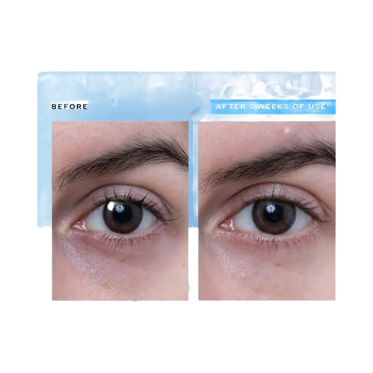 belif Aqua Bomb Depuffing Eye Gel with Caffeine + Hyaluronic Acid