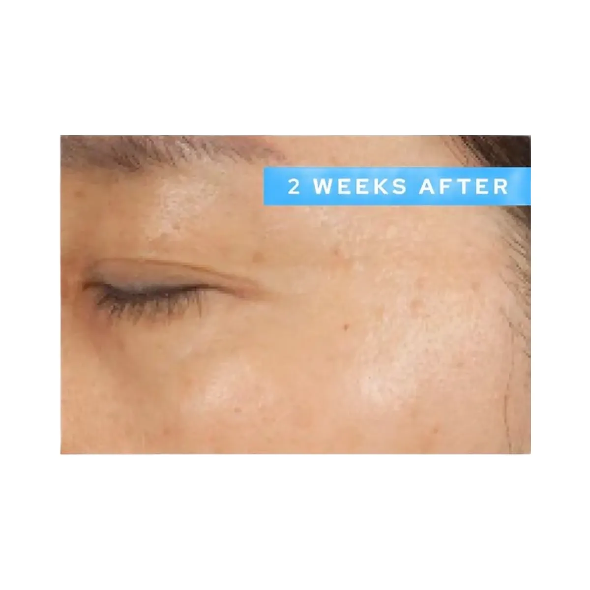 belif Moisturizing Eye Bomb Eye Cream