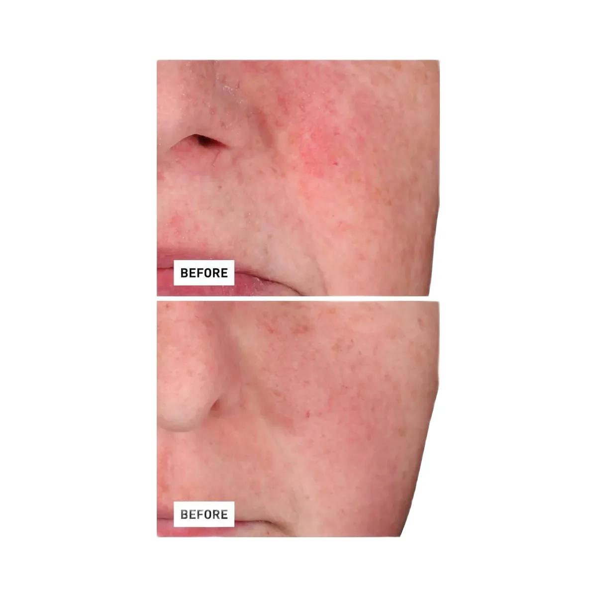 Erborian Centella Red Serum with Korean Centella Asiatica Extract