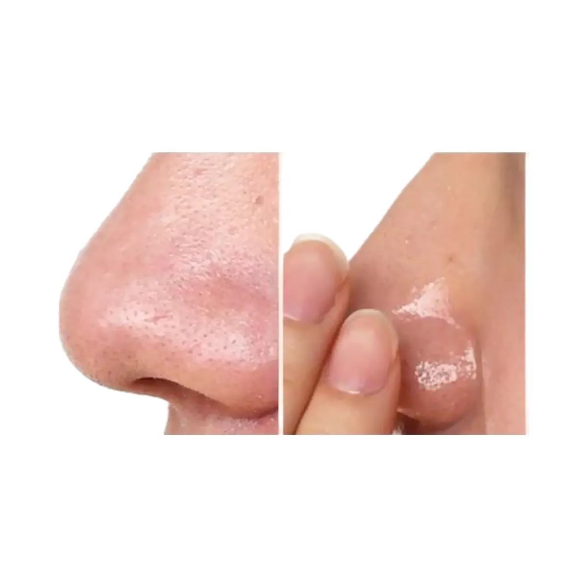 Hanskin Pore Cleansing Balm - BHA