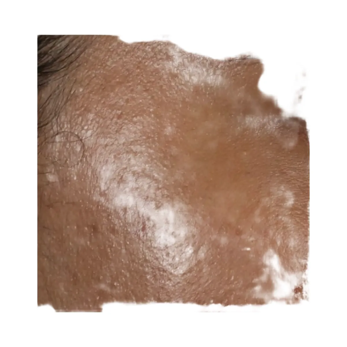 Hero Cosmetics Dark Spot Corrector