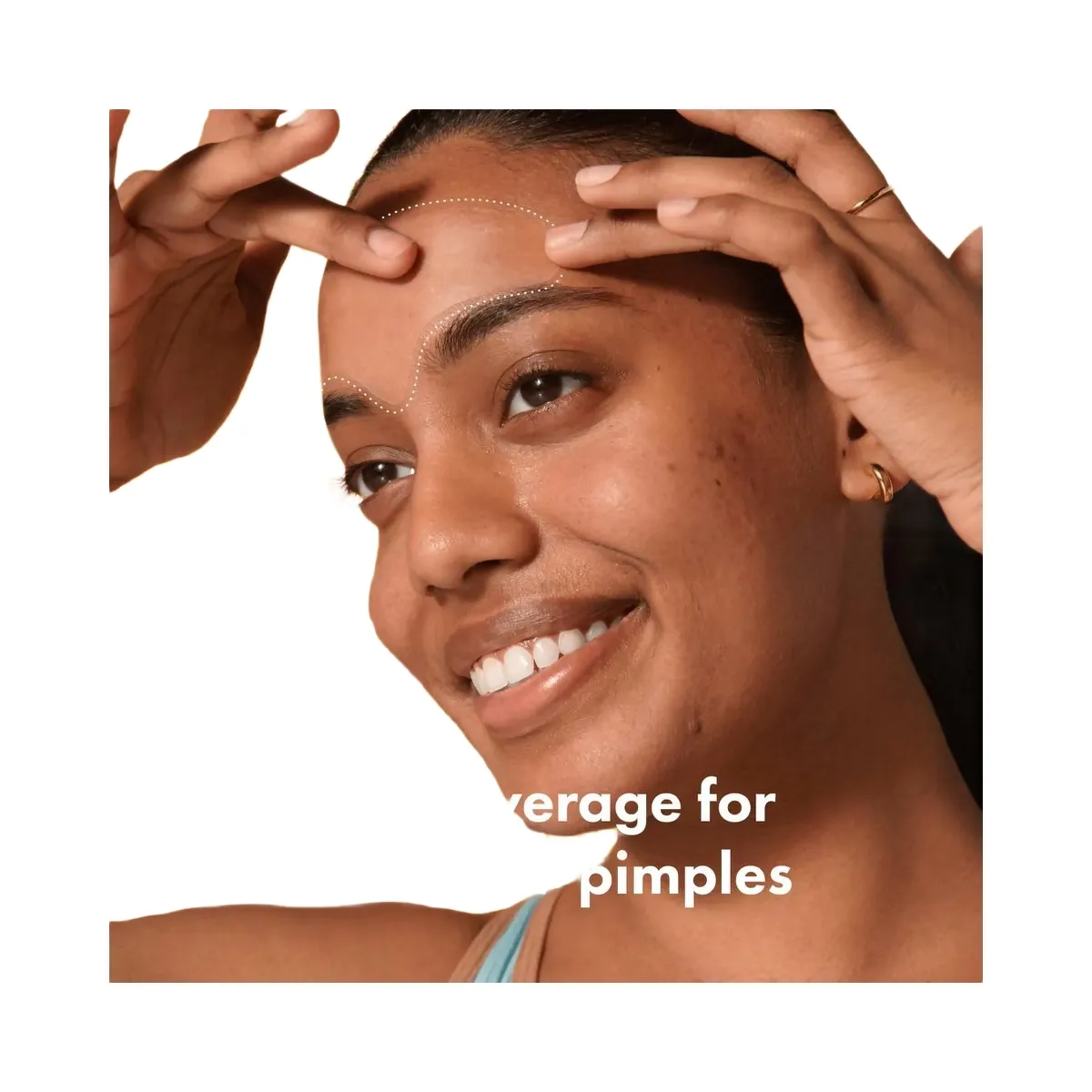 Hero Cosmetics Mighty Patch Forehead Pimple Patches