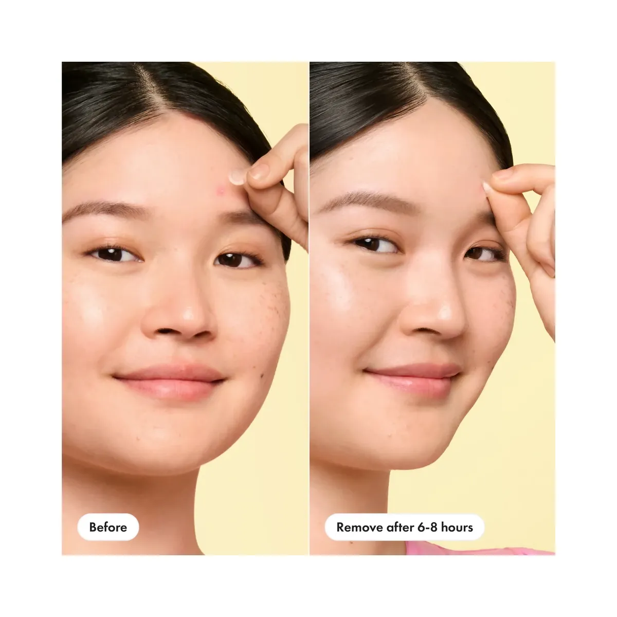 Hero Cosmetics Mighty Patch Mini Invisible+