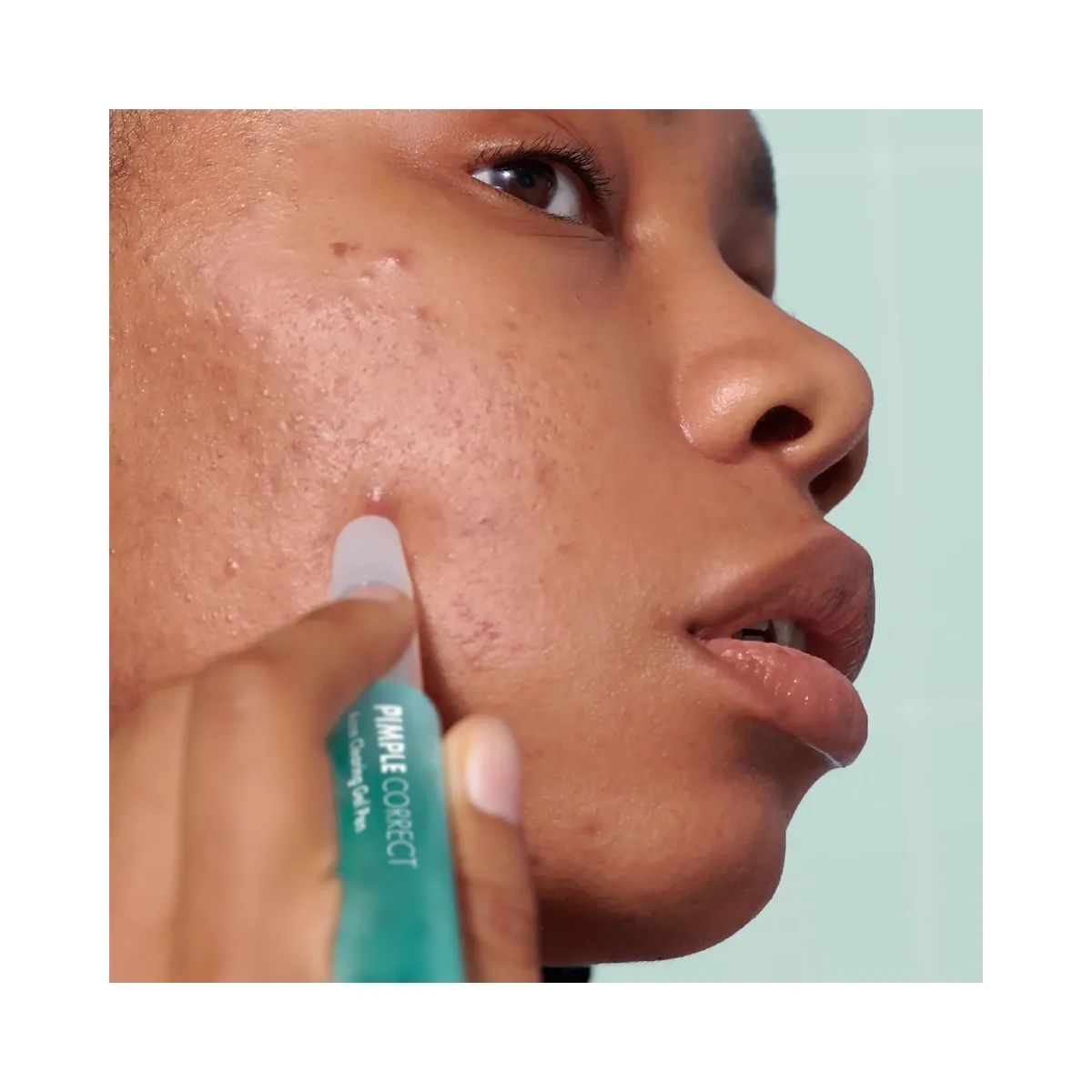 Hero Cosmetics Pimple Correct Acne Clearing Gel Pen