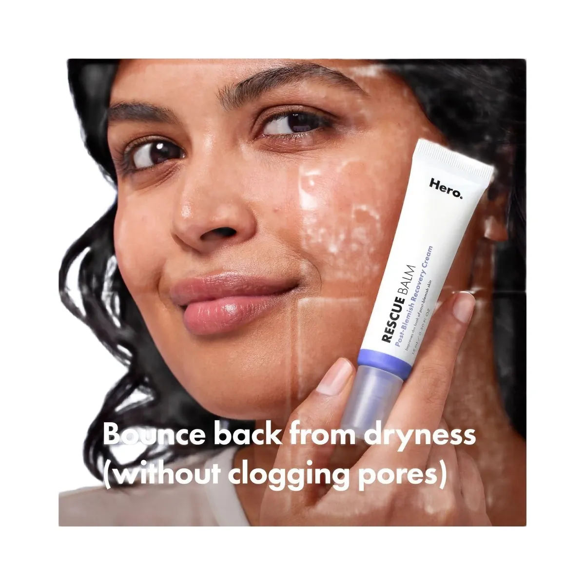 Hero Cosmetics Rescue Balm Post-Blemish Recovery Cream