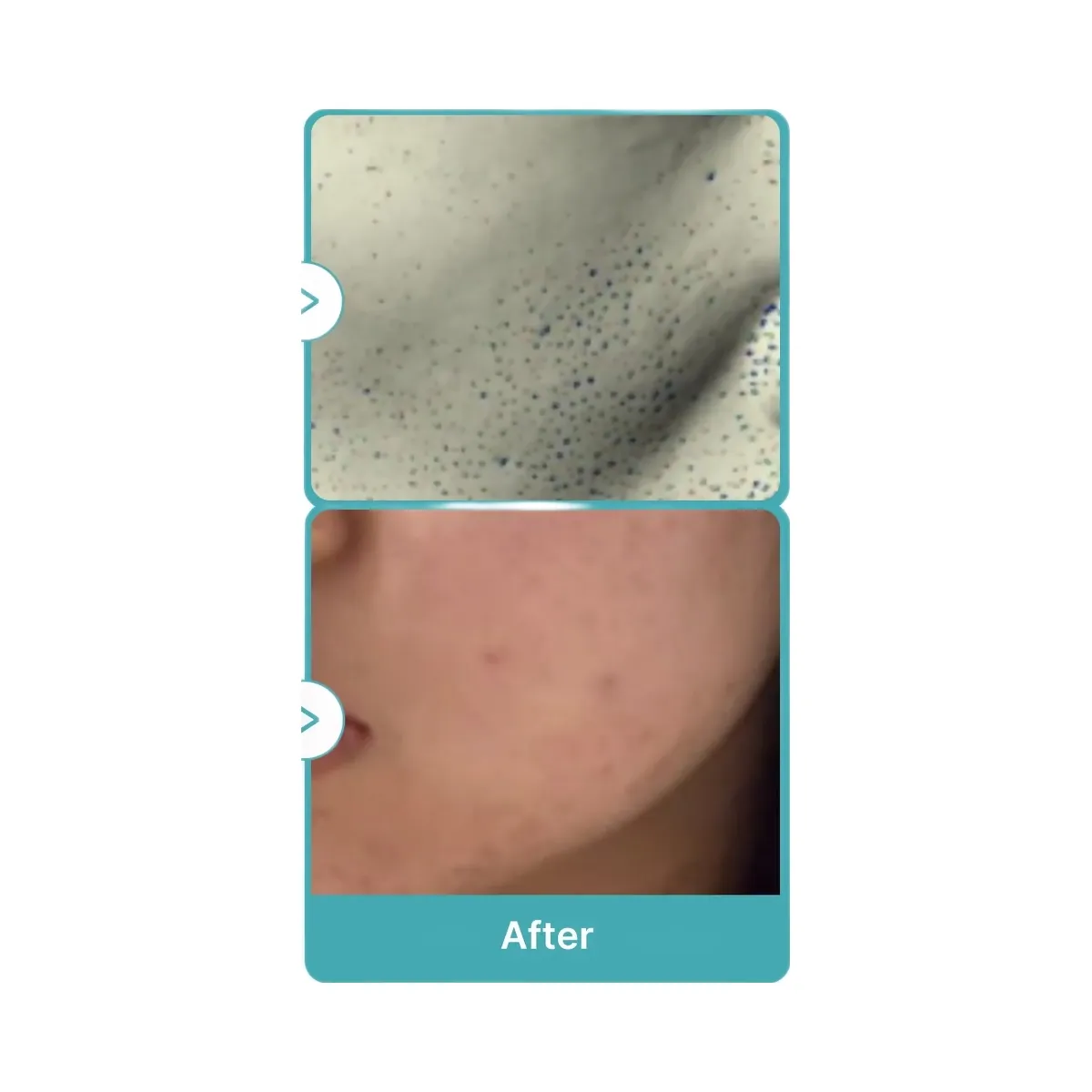 Medicube Azelaic Acid Niacinamide Clarifying Toner