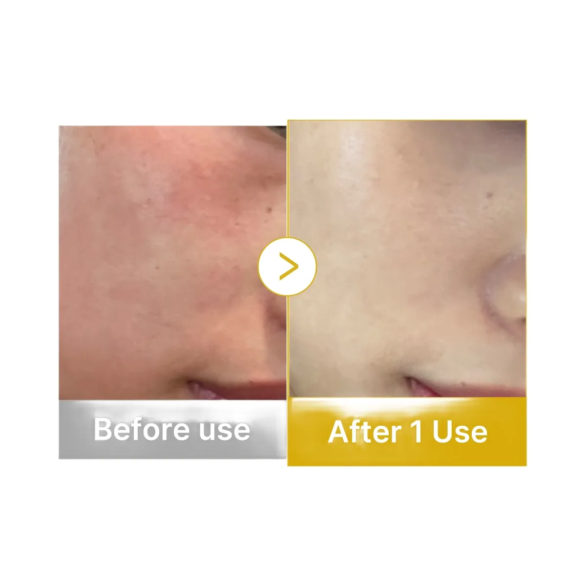 Medicube Kojic Acid Turmeric Vitamin Gold Jelly Mist Serum