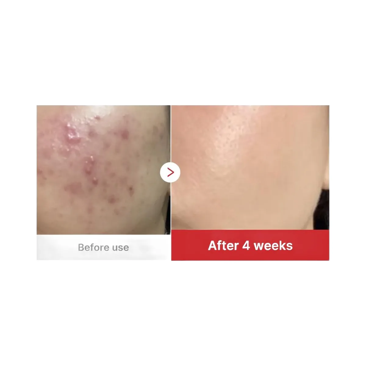 medicube Red Succinic Acid Peeling Pad