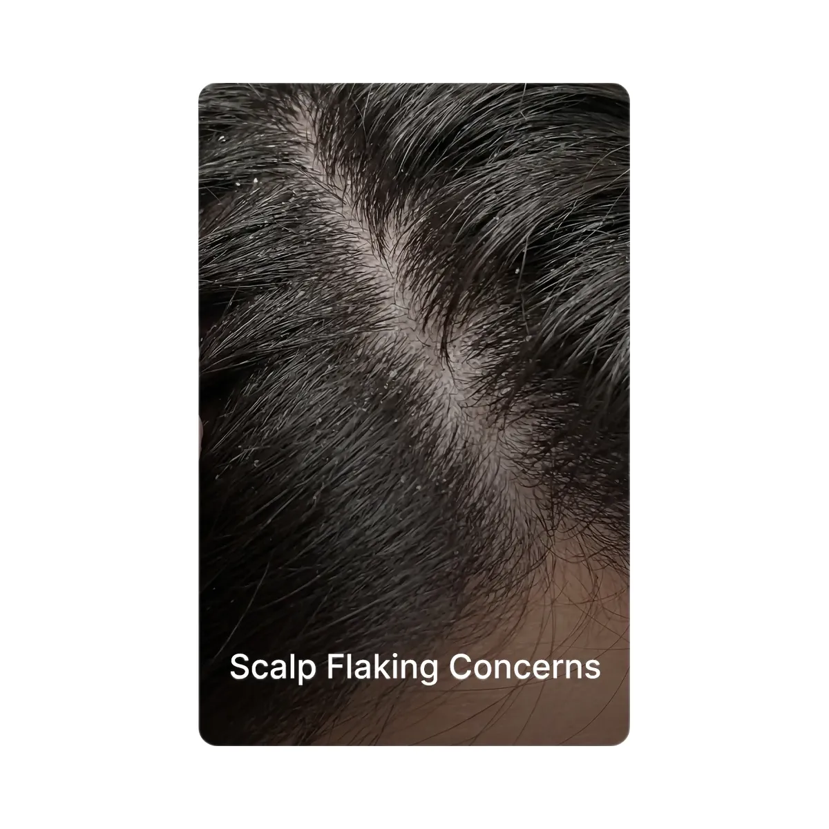 Medicube Rosemary PDRN Scalp Serum
