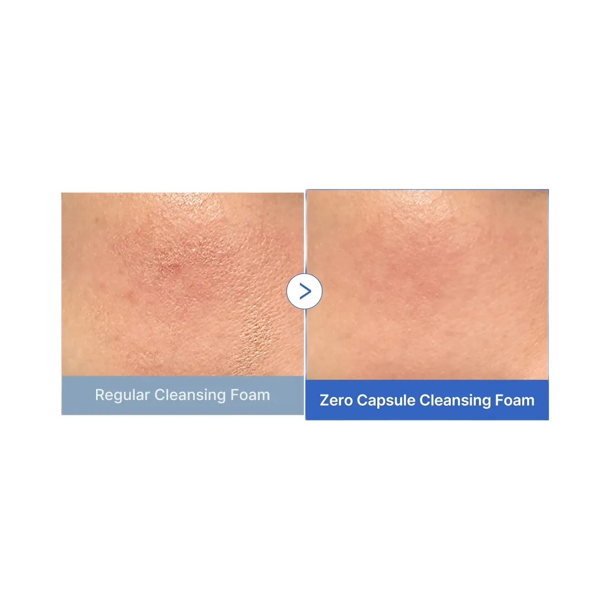 Medicube Zero Pore Capsule Cleansing Foam