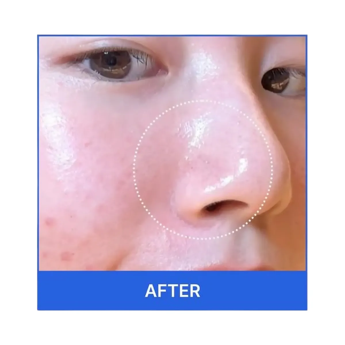 medicube Zero Pore Pad