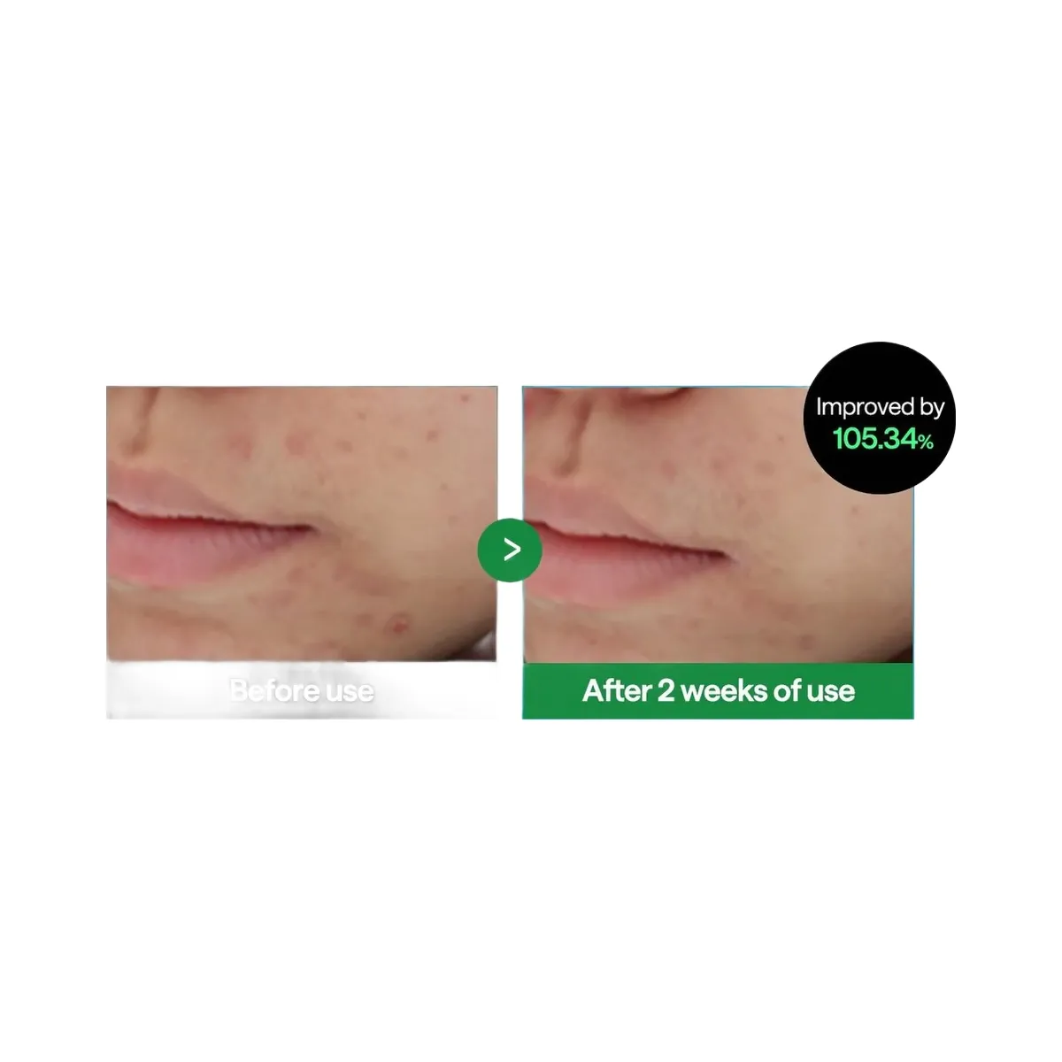 MEDIHEAL Teatree Trouble Calming Cleanser