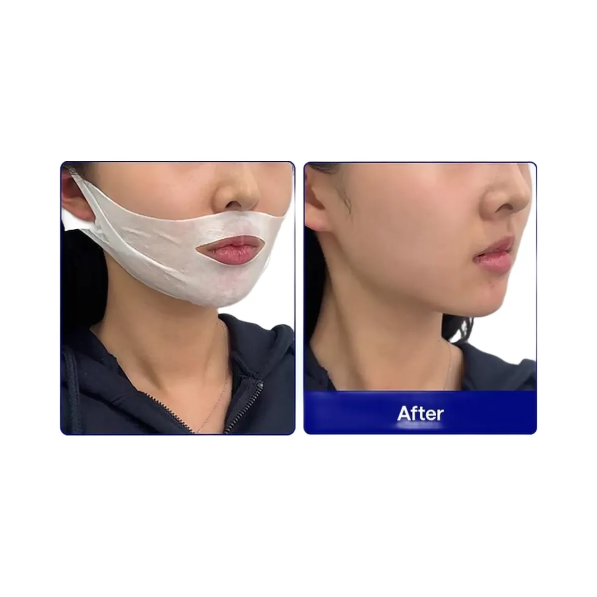 MEDIHEAL V.T.R Stretching Patch
