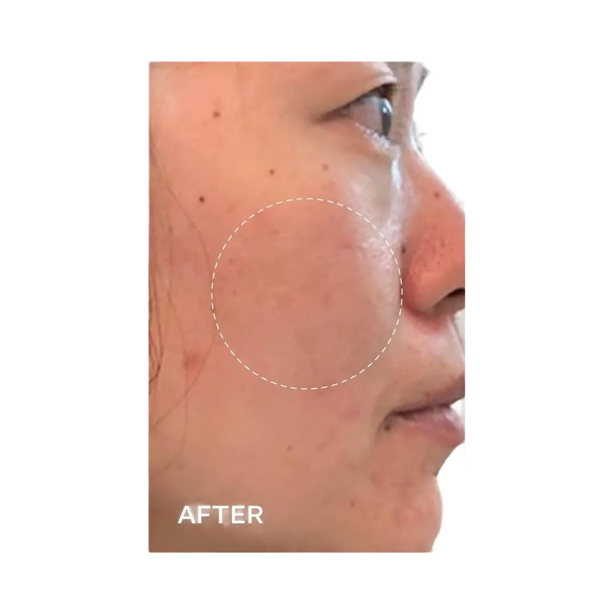 PEACH & LILY Glass Skin Refining Serum