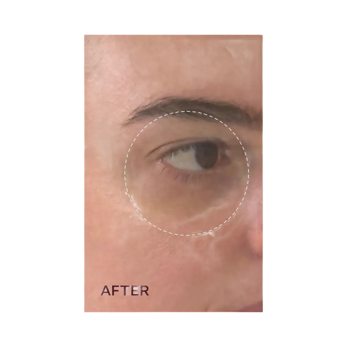 PEACH & LILY Pure Radiance Brightening Eye Cream