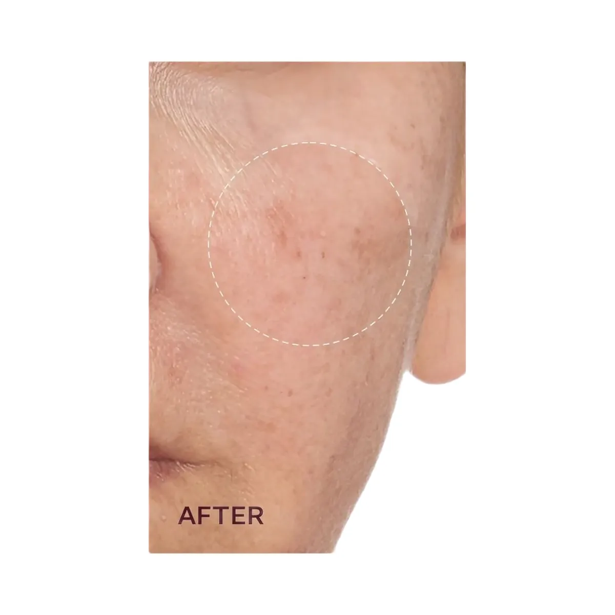 PEACH & LILY Transparen-C Pro Brightening Moisturizer