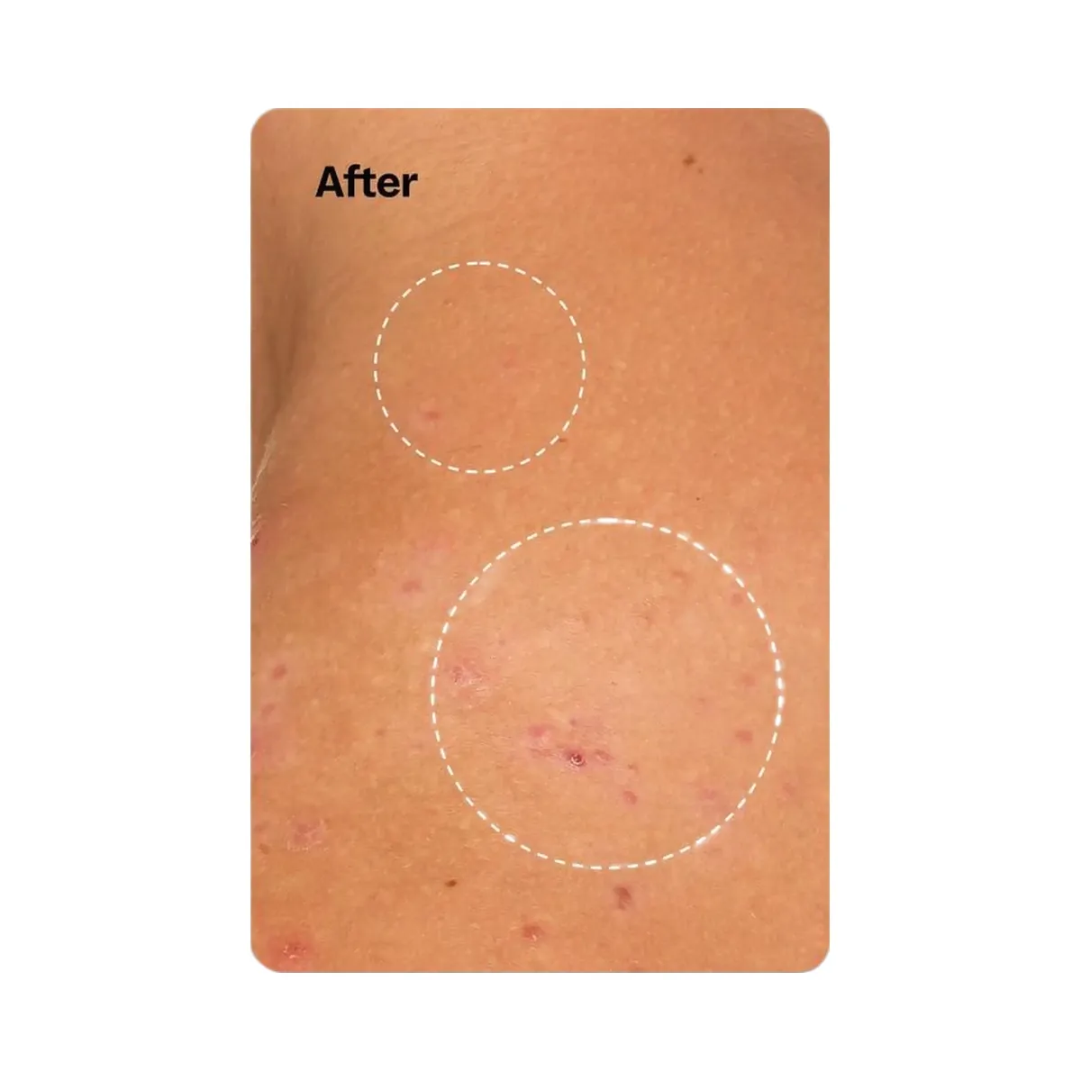 Peach Slices Breakout Banisher Body Spray