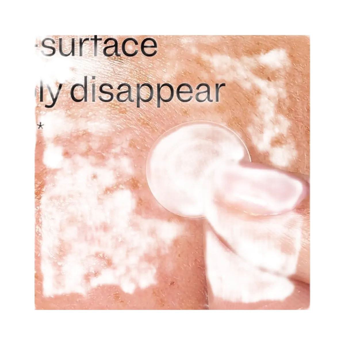 Peach Slices Deep Blemish Microdarts