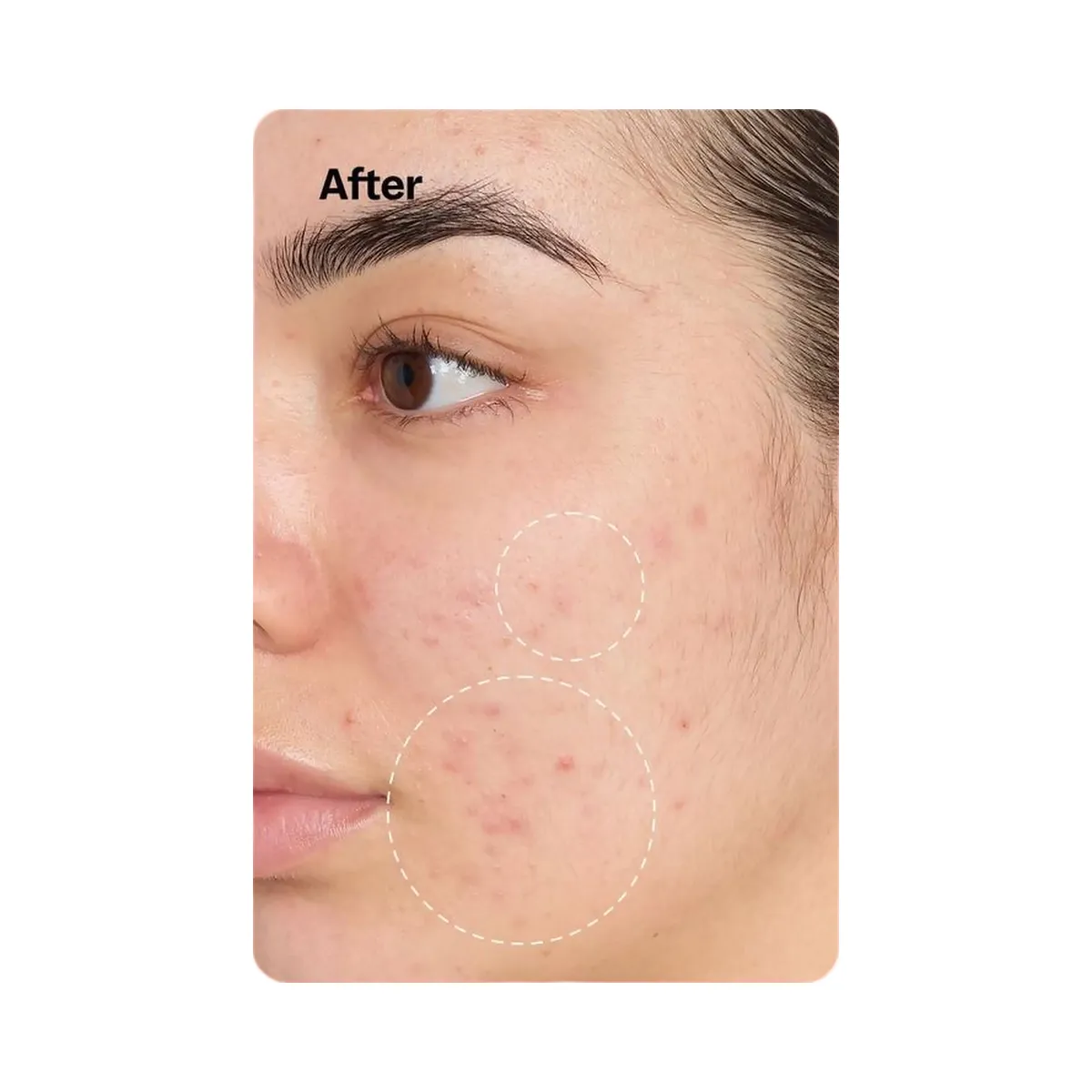 Peach Slices Fix All Recovery Spray
