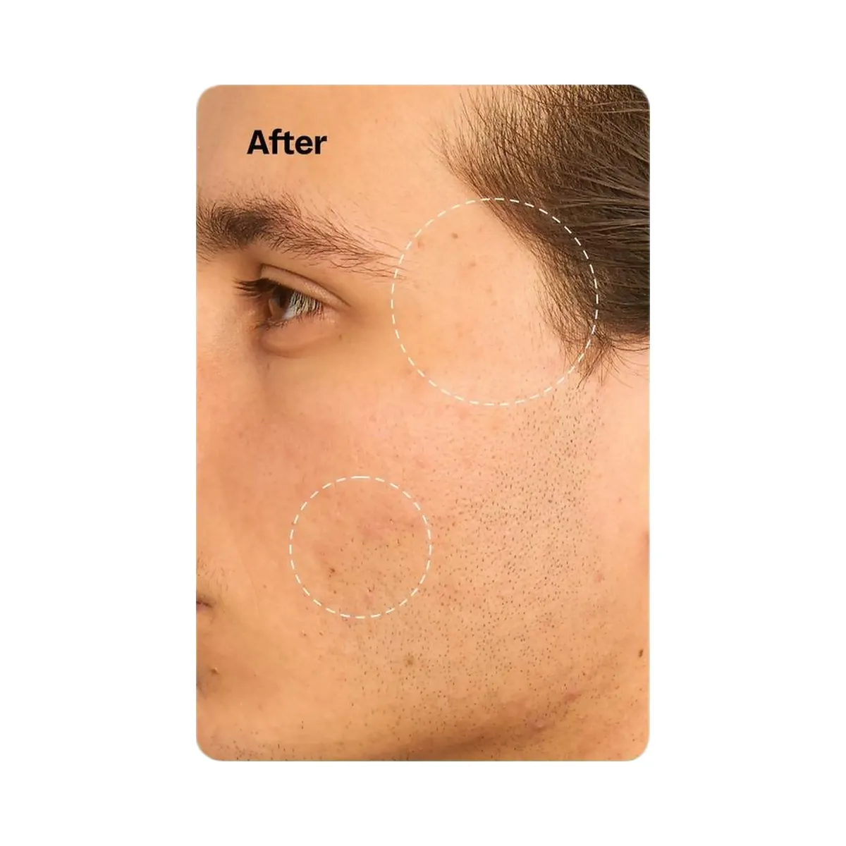 Peach Slices Snail Rescue Blemish Busting Toner