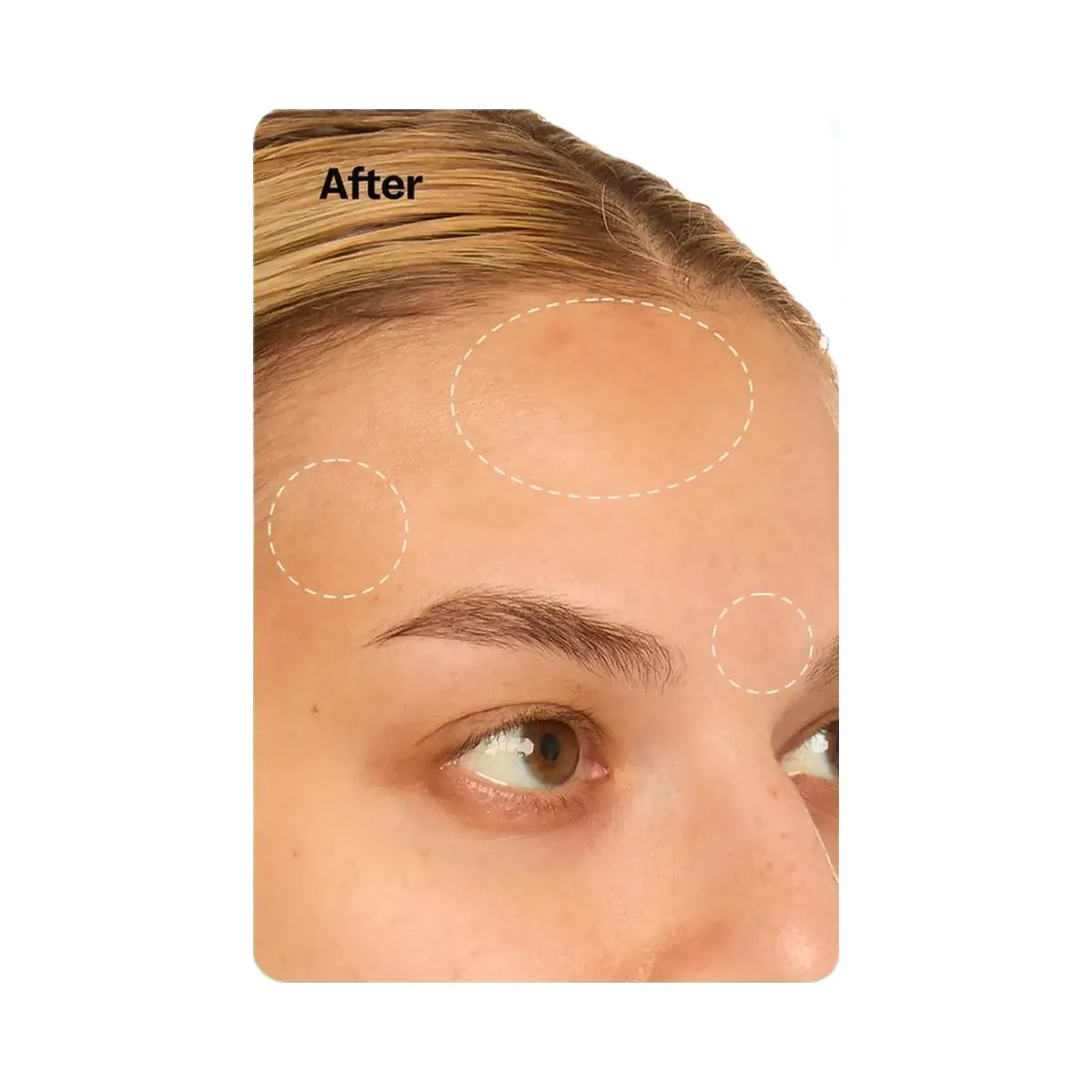 Peach Slices Snail Rescue Intensive Serum