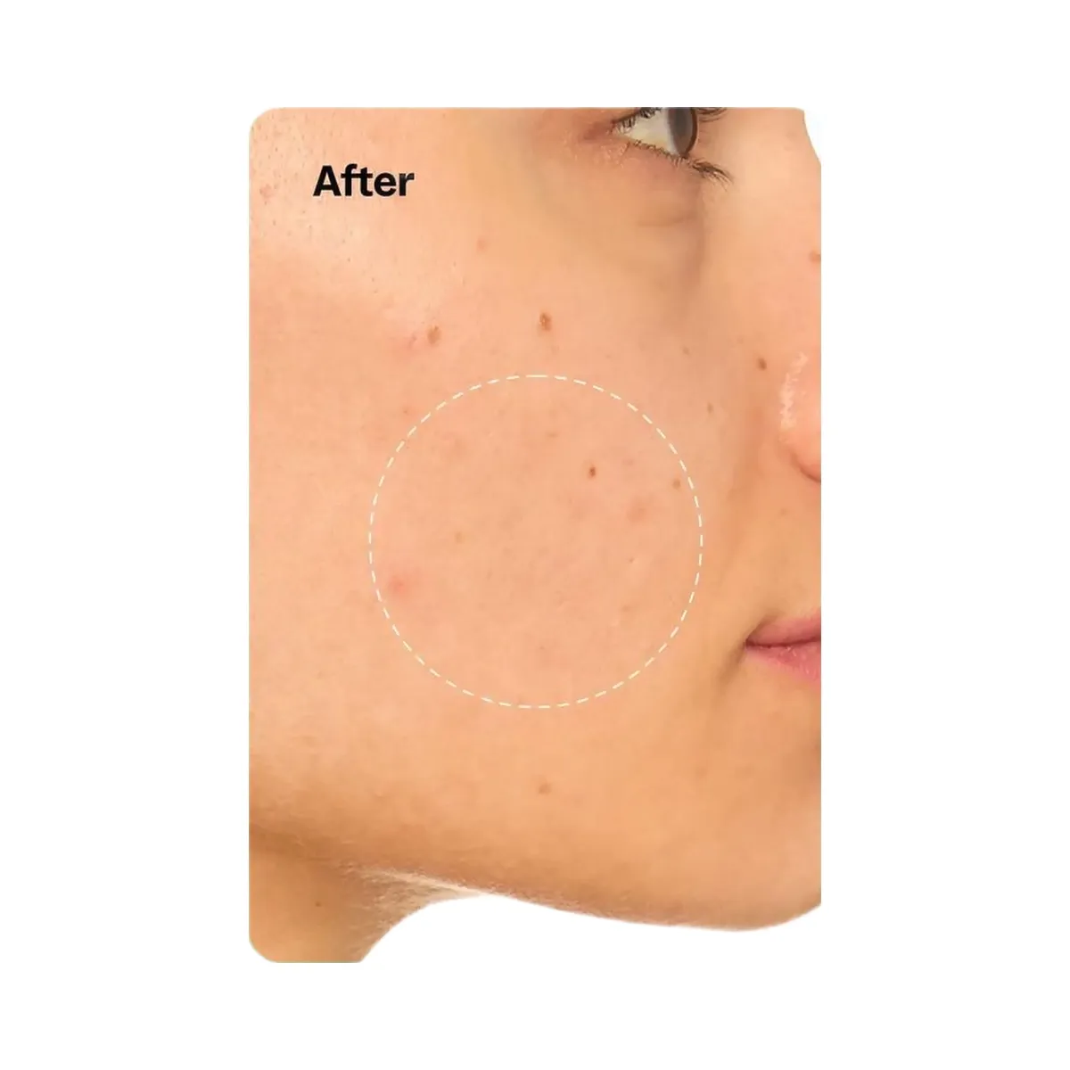 Peach Slices Snail Rescue Intensive Wash-Off Jelly Mask