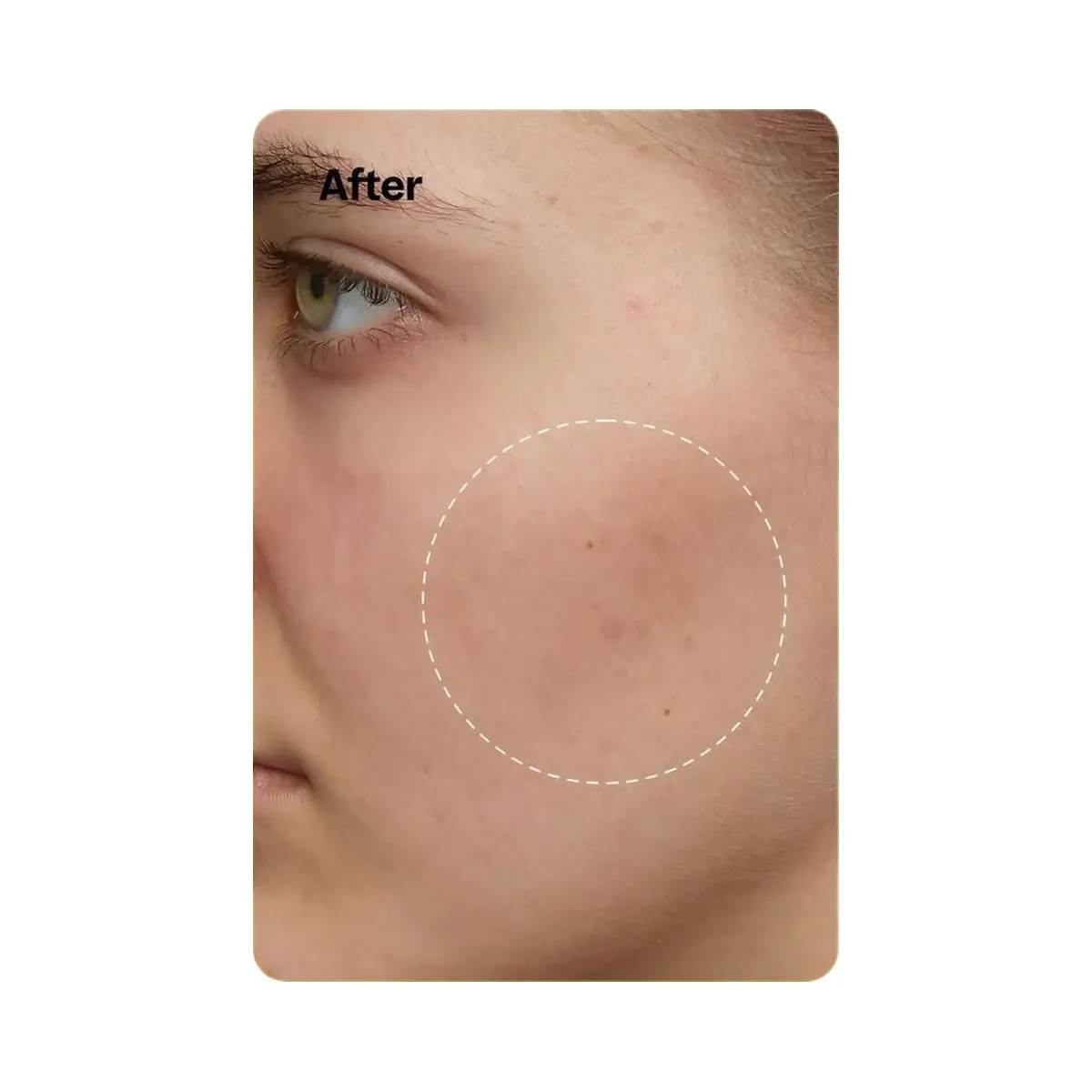 Peach Slices Super Fade Discoloration Moisturizer