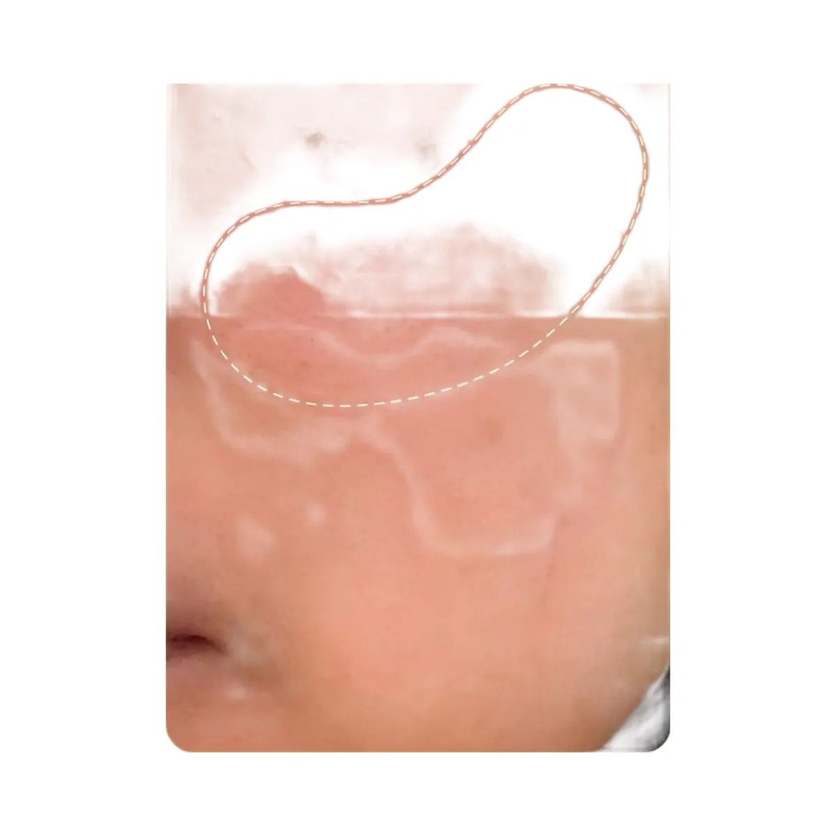 Peach Slices Super Fade Discoloration Serum