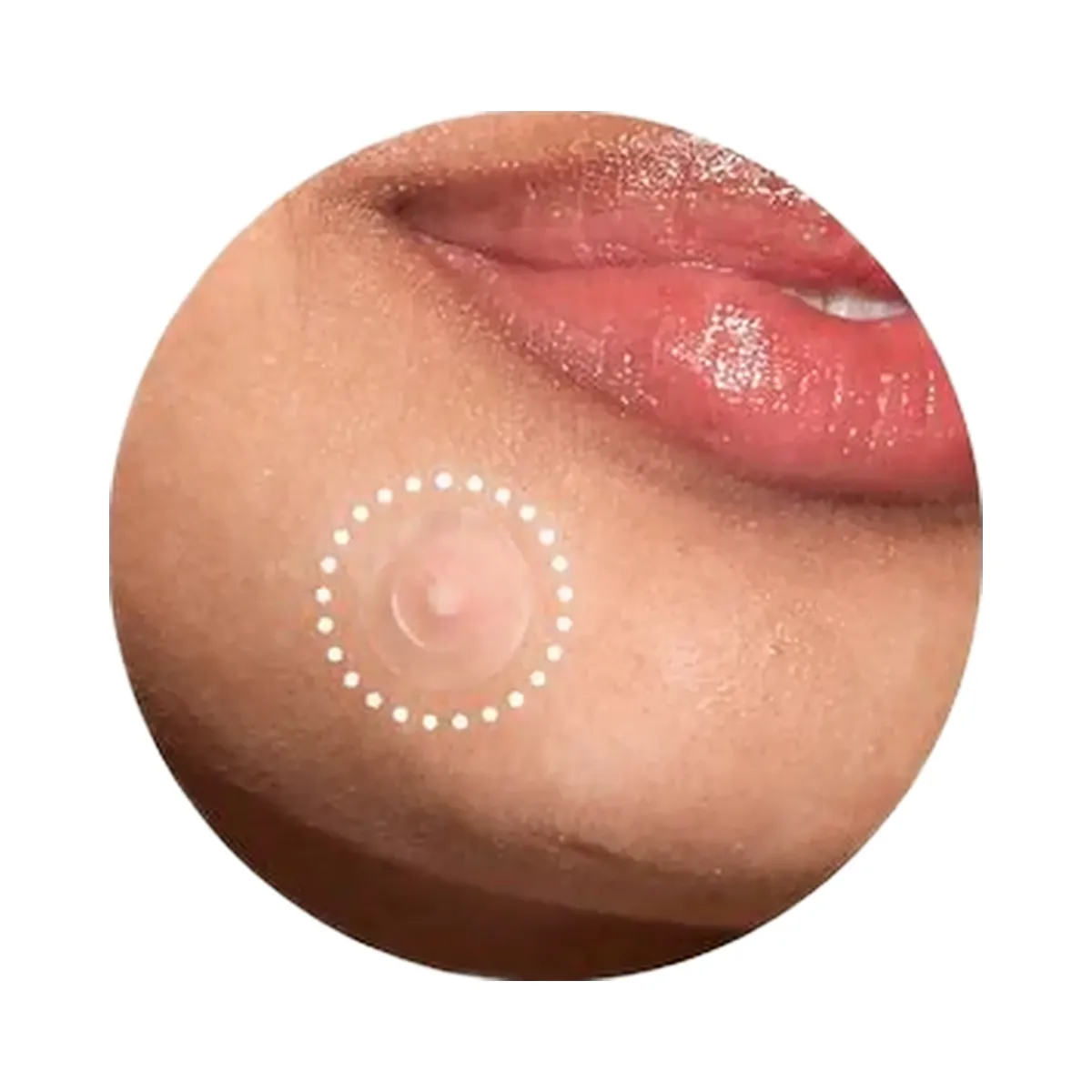 Rael Miracle Patch Invisible Spot Cover