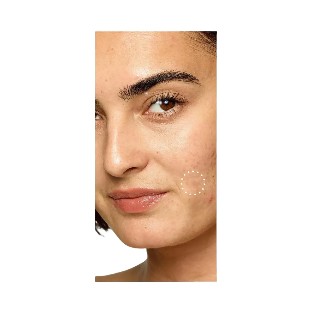 Rael Miracle Patch Retinol Spot Cover