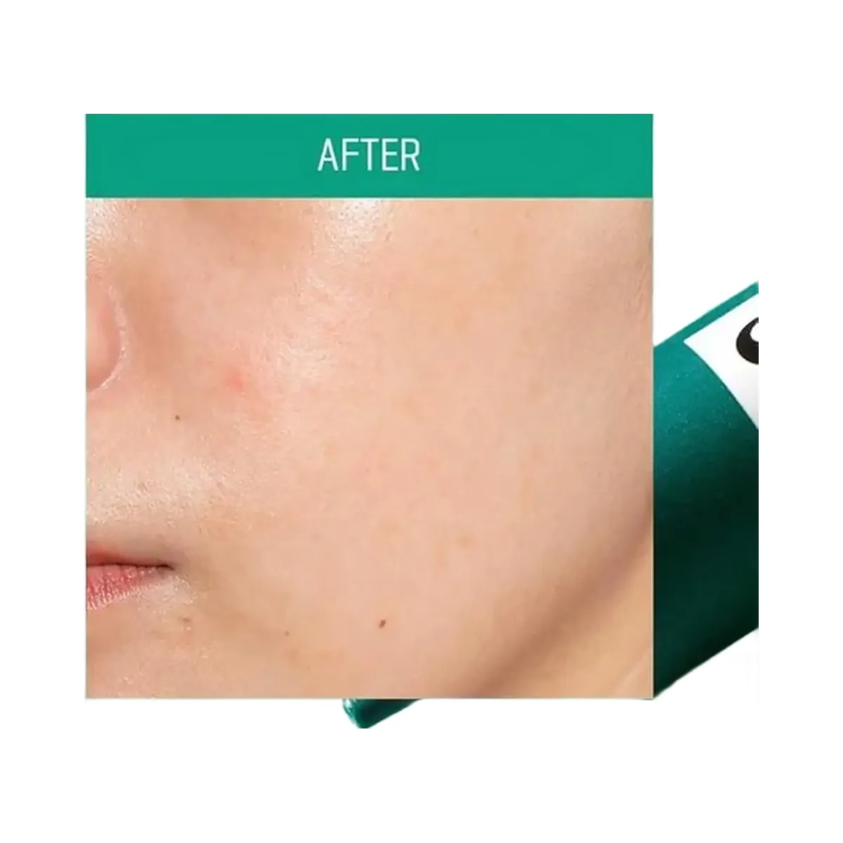 SOME BY MI AHA BHA PHA 14 Days Super Miracle Spot All Kill Cream