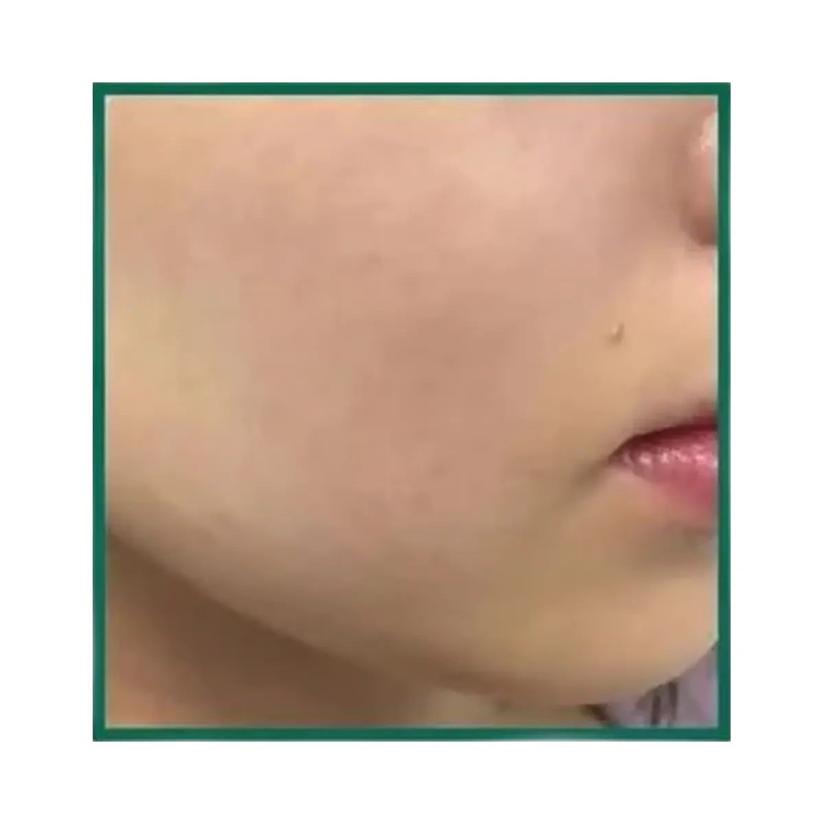 SOME BY MI AHA BHA PHA 30 Day Miracle Exfoliating Toner