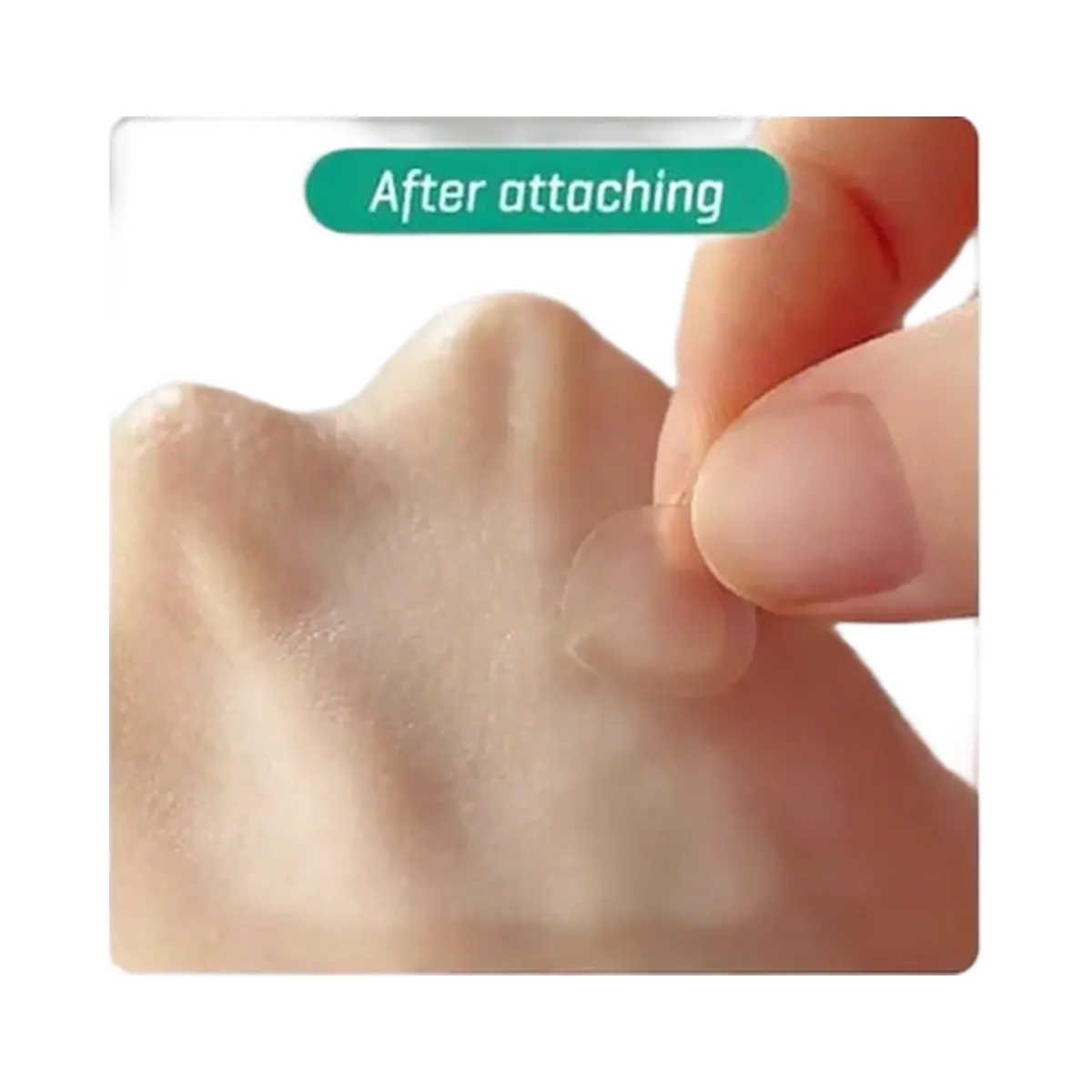 SOME BY MI Clear Spot Patch