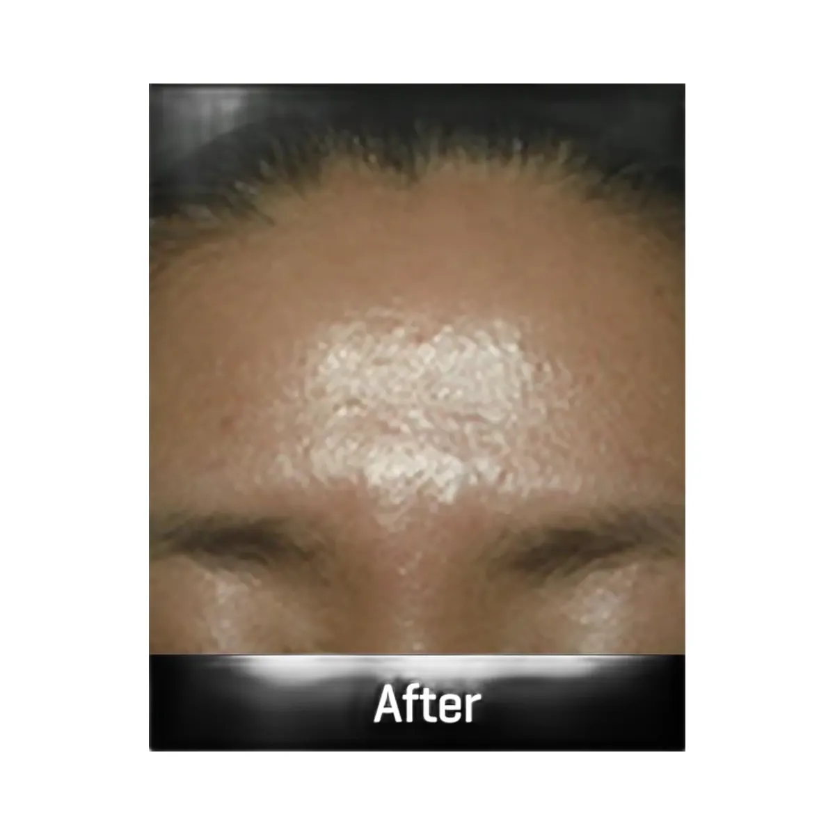 SOME BY MI Galactomyces Pure Vitamin C Glow Serum