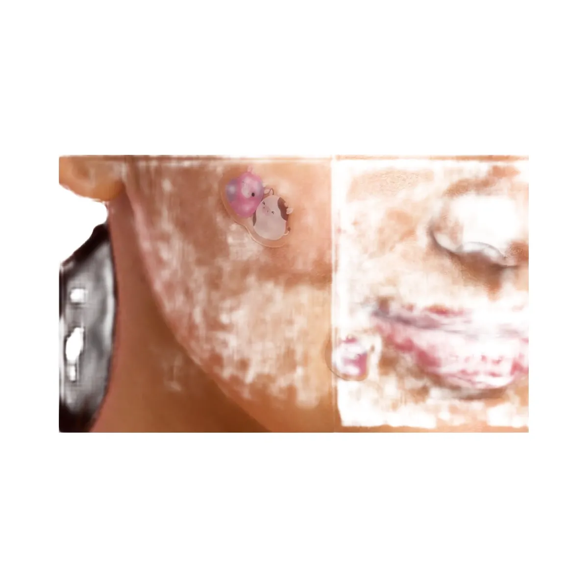 TONYMOLY Squishmallows Hydrocolloid Blemish Patches
